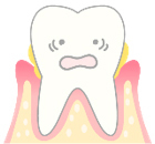 periodontitis-img03